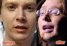 plasticsurgerybeforeafter