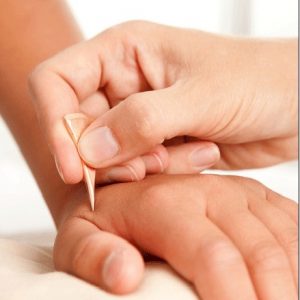 Where Acupuncture and The Western World Converge