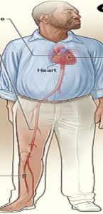 Health Risks From Asbestos Exposure