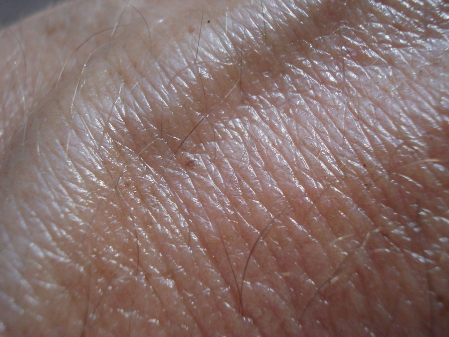 On The Surface: 3 Ways Your Skin Can Tell You Something Is Wrong