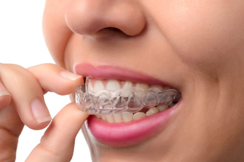 Looking For A Better Smile? How Invisalign Can Help
