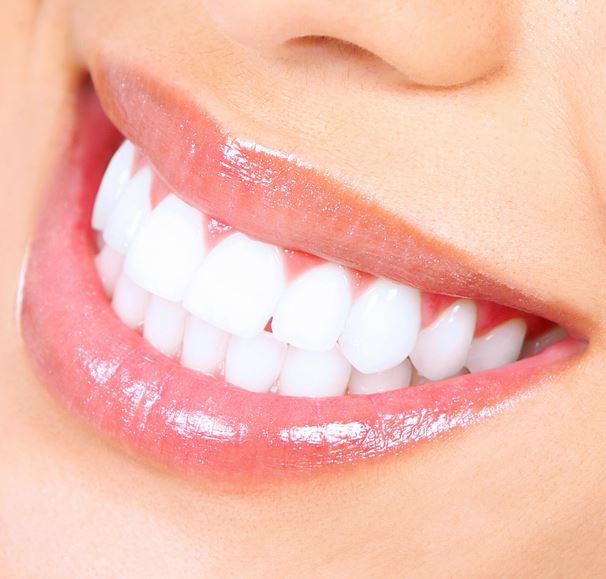Cosmetic Dentistry: 5 Things You Should Know Before Whitening Your Teeth