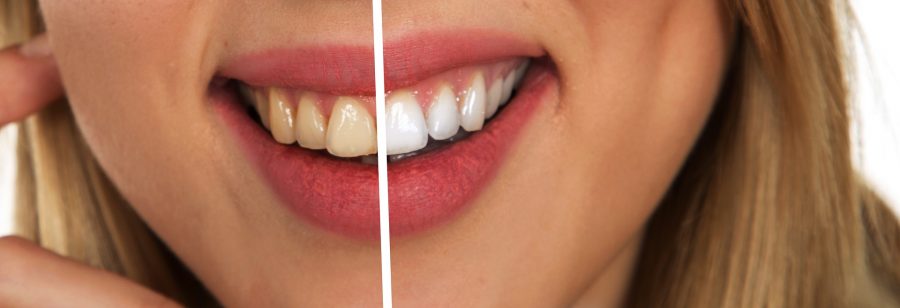 3 Fascinating Modern Methods Dentists Use to Fix Your Teeth