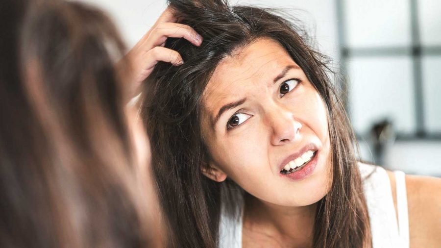 Treating The Dandruff Condition Of Dyed Hair and Itchy Scalp
